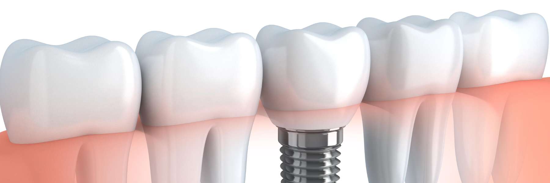 Dental 