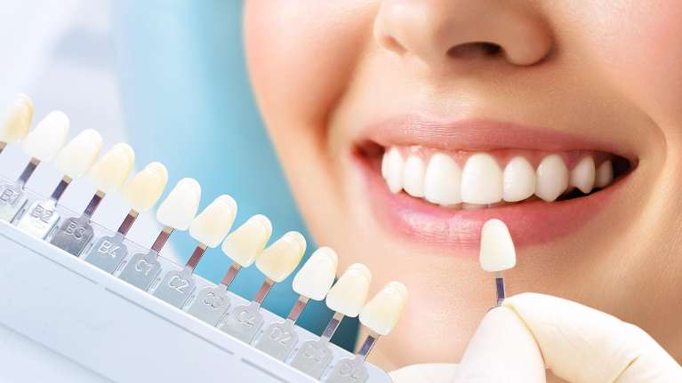 Dentist examining shade guide to match the best white tooth color for a patient’s smile