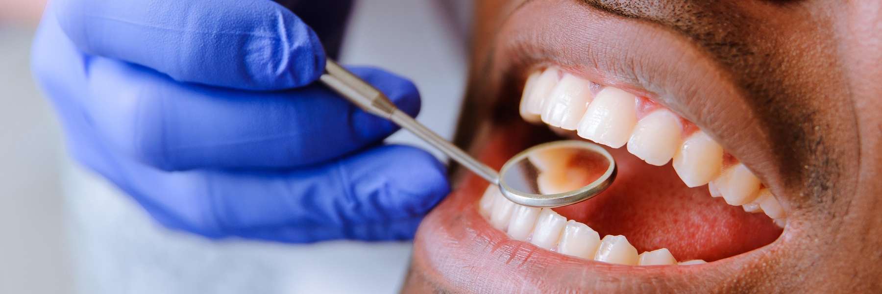 close up of patient with dental tool | foothill ranch dentist